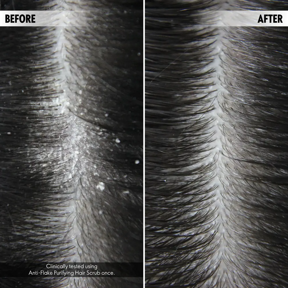 اسکراب ضد پوسته و پاک کننده پوست سر دوولوژی